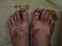 This is what your feet might look like after walking 150 miles in flip flops in six days. Maiu took a zero day to recuperate.
